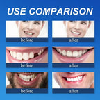 Ends Today: 49.99% OFF! Medical Full Denture with Strong Suction
