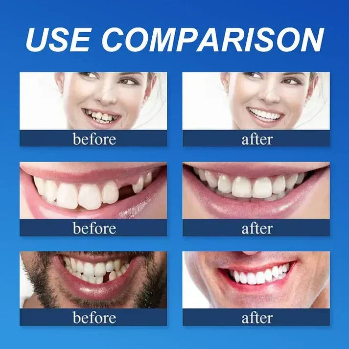 Ends Today: 49.99% OFF! Medical Full Denture with Strong Suction