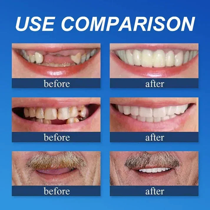 Ends Today: 49.99% OFF! Medical Full Denture with Strong Suction